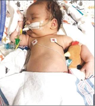 Rare disease leaves local baby fighting for his life